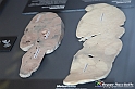 VBS_2716 - Sezioni del fegato - Metastasi - Mostra Body Worlds